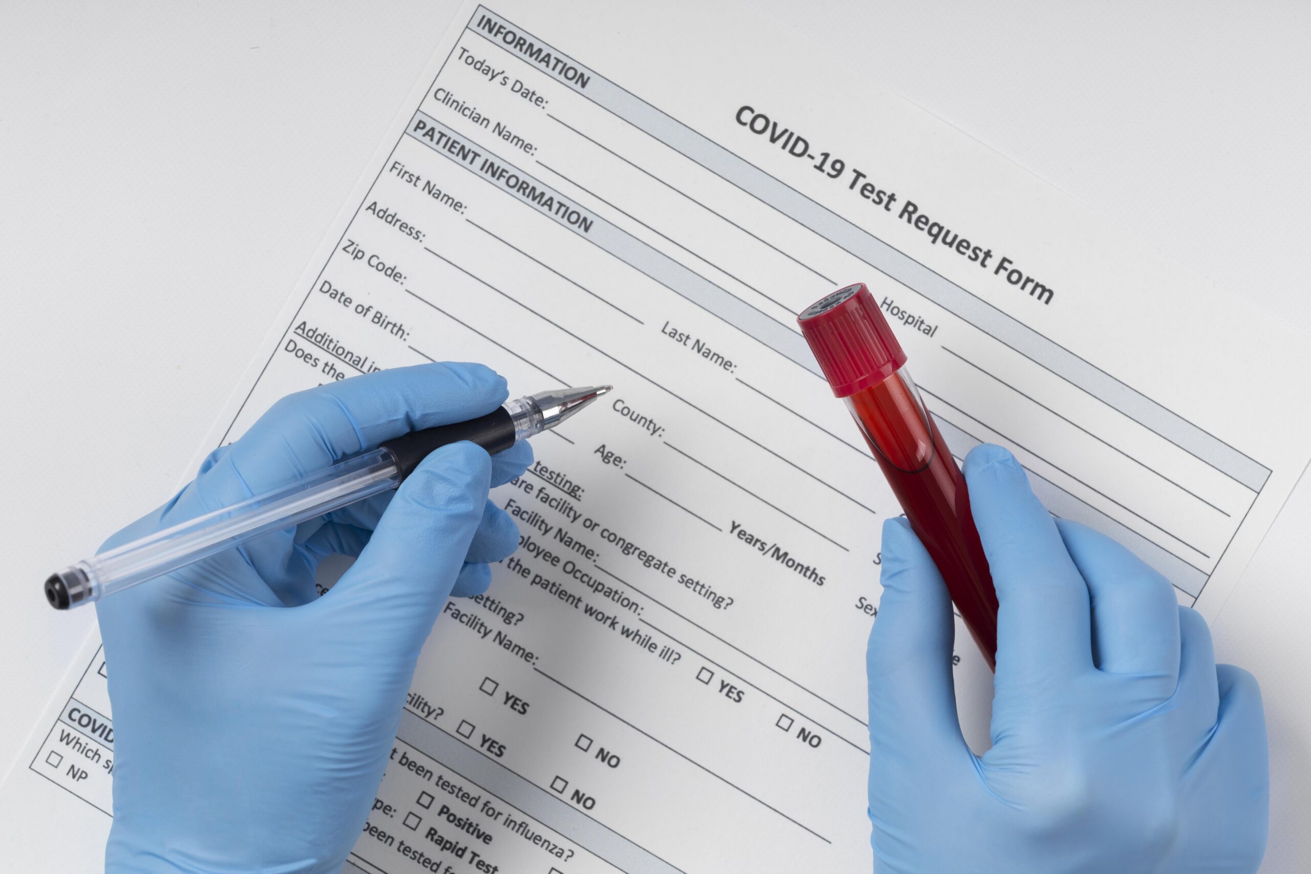 coronavirus-blood-sample-arrangement-lab